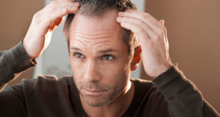 Haarausfall (Alopezie) - Häufigste Ursachen und Hilfe